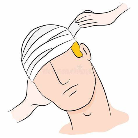 Réinsertion professionnelle du traumatisme crânien : l'incidence professionnelle