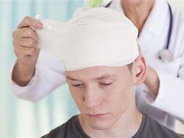 Traumatisme crânien : quel recours ?
